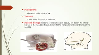  Investigations:
laboratory tests, dental x-ray
 Treatment:
IV Abs , treat the focus of infection
 Incision& drainage: extraoral horizontal incision about 2 cm below the inferior
border of the mandible to avoid injury to the marginal mandibular branch of the
facial N
 
