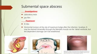 Submental space abscess
Investigations:
 Laboratory tests
 jaw film
Treatment:
 IV Abs
 Horizontal incision at the site of maximum bulge after the infection localizes. It
may be drained intraorally through the Mentalis muscle via the labial vestibule, but
the dependent drainage can’t be established.
 