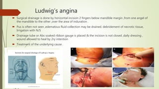 Ludwig’s angina
 Surgical drainage is done by horizontal incision 2 fingers below mandible margin ,from one angel of
the mandible to the other ,over the area of induration .
 Pus is often not seen ,edematous fluid collection may be drained. debridement of necrotic tissue,
Irrigation with N/S
 Drainage tube or Abs soaked ribbon gauge is placed & the incision is not closed ,daily dressing ,
wound allowed to heal by 2ry intention
 Treatment of the underlying cause .
 