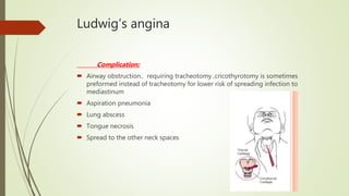 Ludwig’s angina
Complication:
 Airway obstruction.. requiring tracheotomy ,cricothyrotomy is sometimes
preformed instead of tracheotomy for lower risk of spreading infection to
mediastinum
 Aspiration pneumonia
 Lung abscess
 Tongue necrosis
 Spread to the other neck spaces
 
