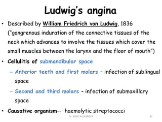 Ludwig’s angina
• Described by William Friedrich von Ludwig, 1836
(“gangrenous induration of the connective tissues of the
neck which advances to involve the tissues which cover the
small muscles between the larynx and the floor of mouth”)
• Cellulitis of submandibular space
– Anterior teeth and first molars – infection of sublingual
space
– Second and third molars – infection of submaxillary
space
• Causative organism-- haemolytic streptococci
40
Dr. ASHLY ALEXANDER
 