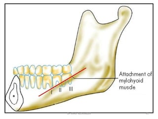 41
Dr. ASHLY ALEXANDER
 