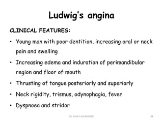 Ludwig’s angina
CLINICAL FEATURES:
• Young man with poor dentition, increasing oral or neck
pain and swelling
• Increasing edema and induration of perimandibular
region and floor of mouth
• Thrusting of tongue posteriorly and superiorly
• Neck rigidity, trismus, odynophagia, fever
• Dyspnoea and stridor
44
Dr. ASHLY ALEXANDER
 