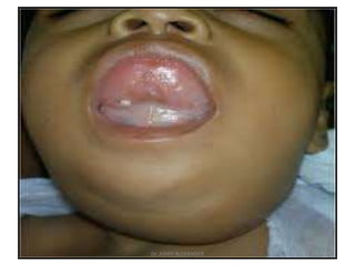 46
Dr. ASHLY ALEXANDER
 