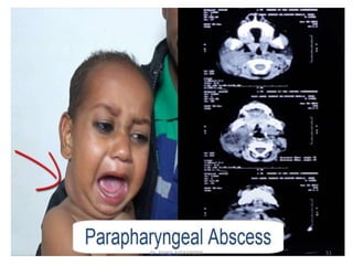 51
Dr. ASHLY ALEXANDER
 