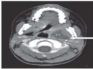 52
Dr. ASHLY ALEXANDER
 