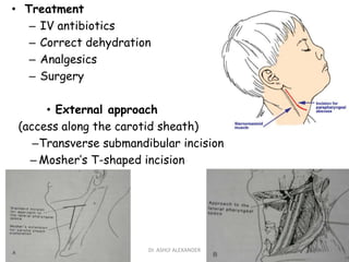 • Treatment
– IV antibiotics
– Correct dehydration
– Analgesics
– Surgery
• External approach
(access along the carotid sheath)
–Transverse submandibular incision
– Mosher’s T-shaped incision
53
Dr. ASHLY ALEXANDER
 