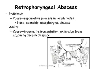 Retropharyngeal Abscess
• Pediatrics
– Cause—suppurative process in lymph nodes
• Nose, adenoids, nasopharynx, sinuses
• Adults
– Cause—trauma, instrumentation, extension from
adjoining deep neck space
58
Dr. ASHLY ALEXANDER
 