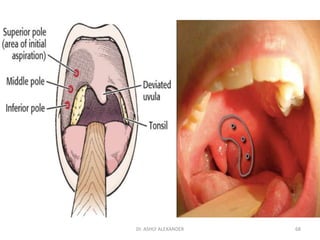 68
Dr. ASHLY ALEXANDER
 