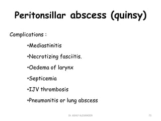 Peritonsillar abscess (quinsy)
Complications :
•Mediastinitis
•Necrotizing fasciitis.
•Oedema of larynx
•Septicemia
•IJV thrombosis
•Pneumonitis or lung abscess
73
Dr. ASHLY ALEXANDER
 