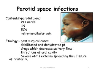 Parotid space infections
Contents:-parotid gland
VII nerve
LN
ECA
retromandibular vein
Etiology:- post surgical cases
debilitated and dehydrated pt
drugs which decrease salivary flow
Infections of oral cavity
Severe otitis externa spreading thru fissure
of Santorini.
74
Dr. ASHLY ALEXANDER
 