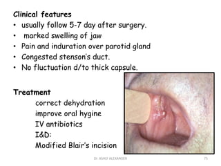 Clinical features
• usually follow 5-7 day after surgery.
• marked swelling of jaw
• Pain and induration over parotid gland
• Congested stenson’s duct.
• No fluctuation d/to thick capsule.
Treatment
correct dehydration
improve oral hygine
IV antibiotics
I&D:
Modified Blair’s incision
75
Dr. ASHLY ALEXANDER
 