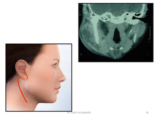 76
Dr. ASHLY ALEXANDER
 