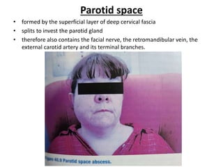 Parotid space
• formed by the superficial layer of deep cervical fascia
• splits to invest the parotid gland
• therefore also contains the facial nerve, the retromandibular vein, the
external carotid artery and its terminal branches.
 