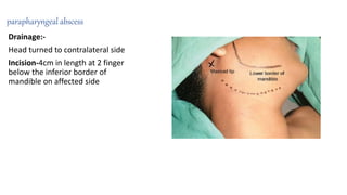 parapharyngeal abscess
Drainage:-
Head turned to contralateral side
Incision-4cm in length at 2 finger
below the inferior border of
mandible on affected side
 