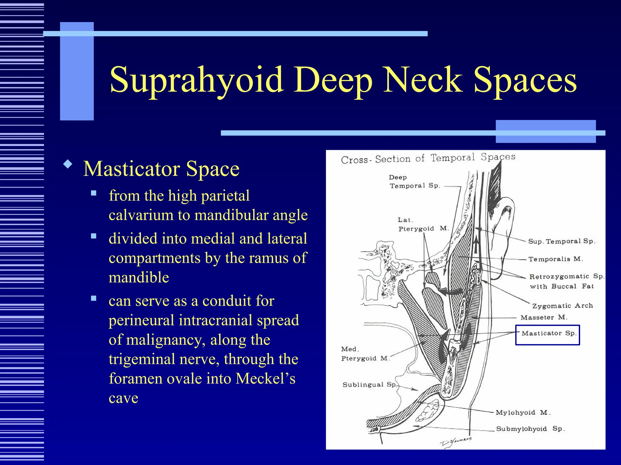 Suprahyoid Deep Neck Spaces
 Masticator Space

from the high parietal
calvarium to mandibular angle

divided into medial and lateral
compartments by the ramus of
mandible
 can serve as a conduit for
perineural intracranial spread
of malignancy, along the
trigeminal nerve, through the
foramen ovale into Meckel’s
cave
 