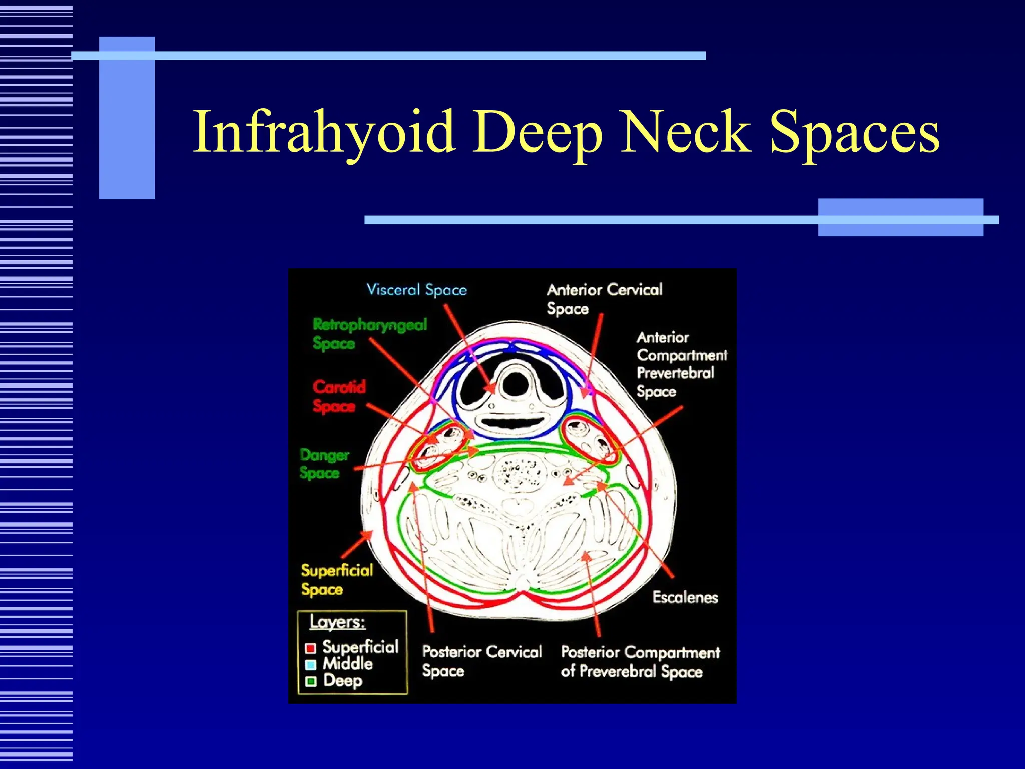 Infrahyoid Deep Neck Spaces
 