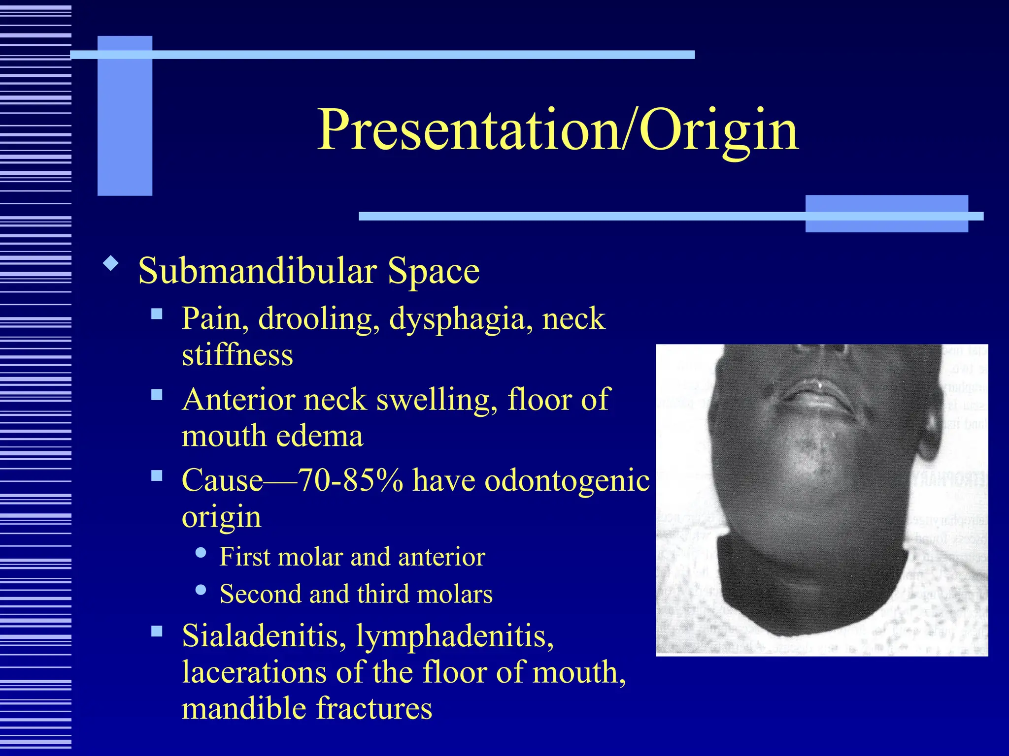 Presentation/Origin
 Submandibular Space
 Pain, drooling, dysphagia, neck
stiffness
 Anterior neck swelling, floor of
mouth edema
 Cause—70-85% have odontogenic
origin
 First molar and anterior
 Second and third molars
 Sialadenitis, lymphadenitis,
lacerations of the floor of mouth,
mandible fractures
 