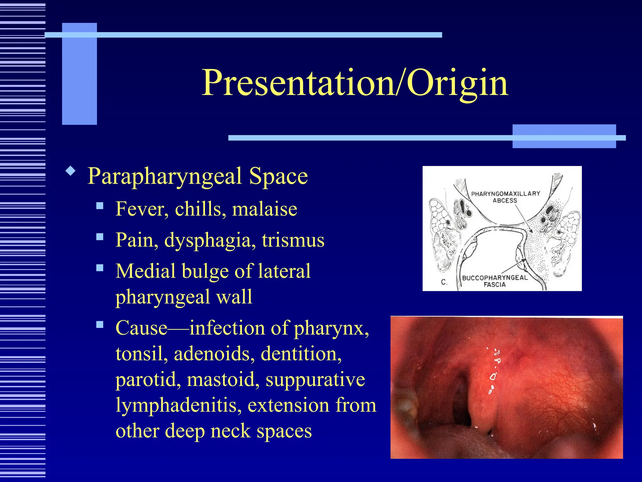 Presentation/Origin
 Parapharyngeal Space
 Fever, chills, malaise
 Pain, dysphagia, trismus
 Medial bulge of lateral
pharyngeal wall
 Cause—infection of pharynx,
tonsil, adenoids, dentition,
parotid, mastoid, suppurative
lymphadenitis, extension from
other deep neck spaces
 