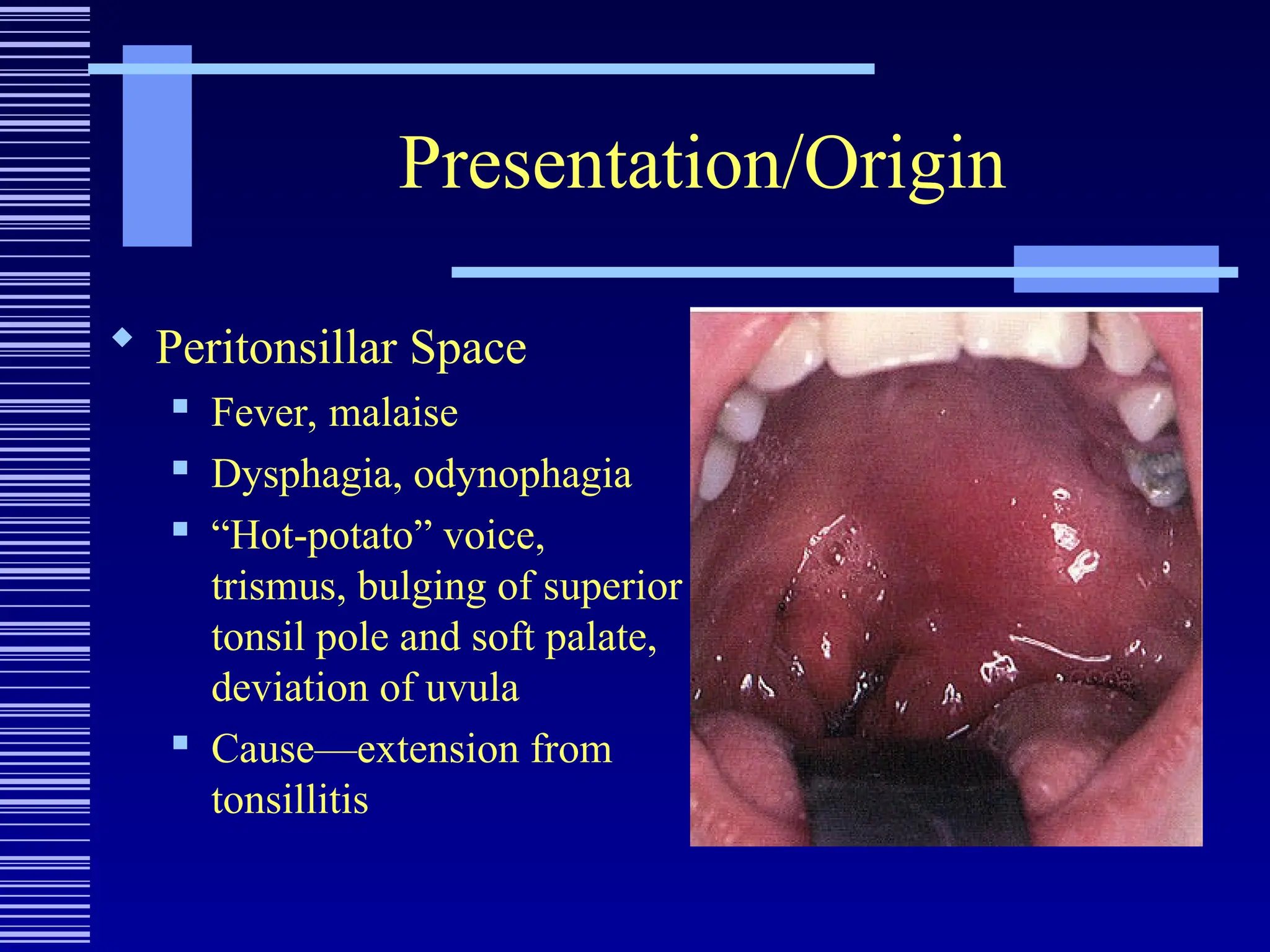 Presentation/Origin
 Peritonsillar Space
 Fever, malaise
 Dysphagia, odynophagia
 “Hot-potato” voice,
trismus, bulging of superior
tonsil pole and soft palate,
deviation of uvula
 Cause—extension from
tonsillitis
 
