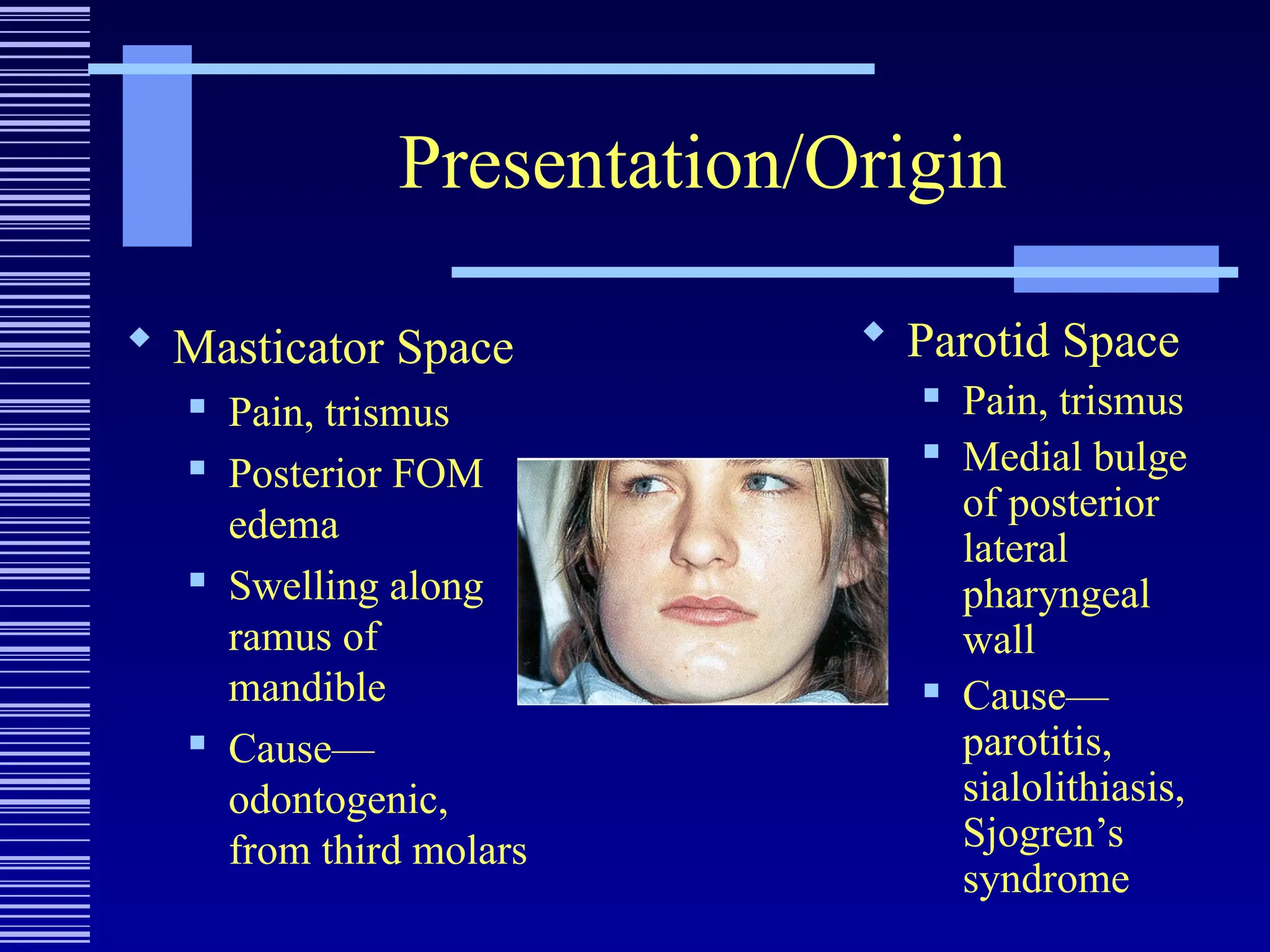Presentation/Origin
 Masticator Space
 Pain, trismus
 Posterior FOM
edema
 Swelling along
ramus of
mandible
 Cause—
odontogenic,
from third molars
 Parotid Space
 Pain, trismus
 Medial bulge
of posterior
lateral
pharyngeal
wall
 Cause—
parotitis,
sialolithiasis,
Sjogren’s
syndrome
 