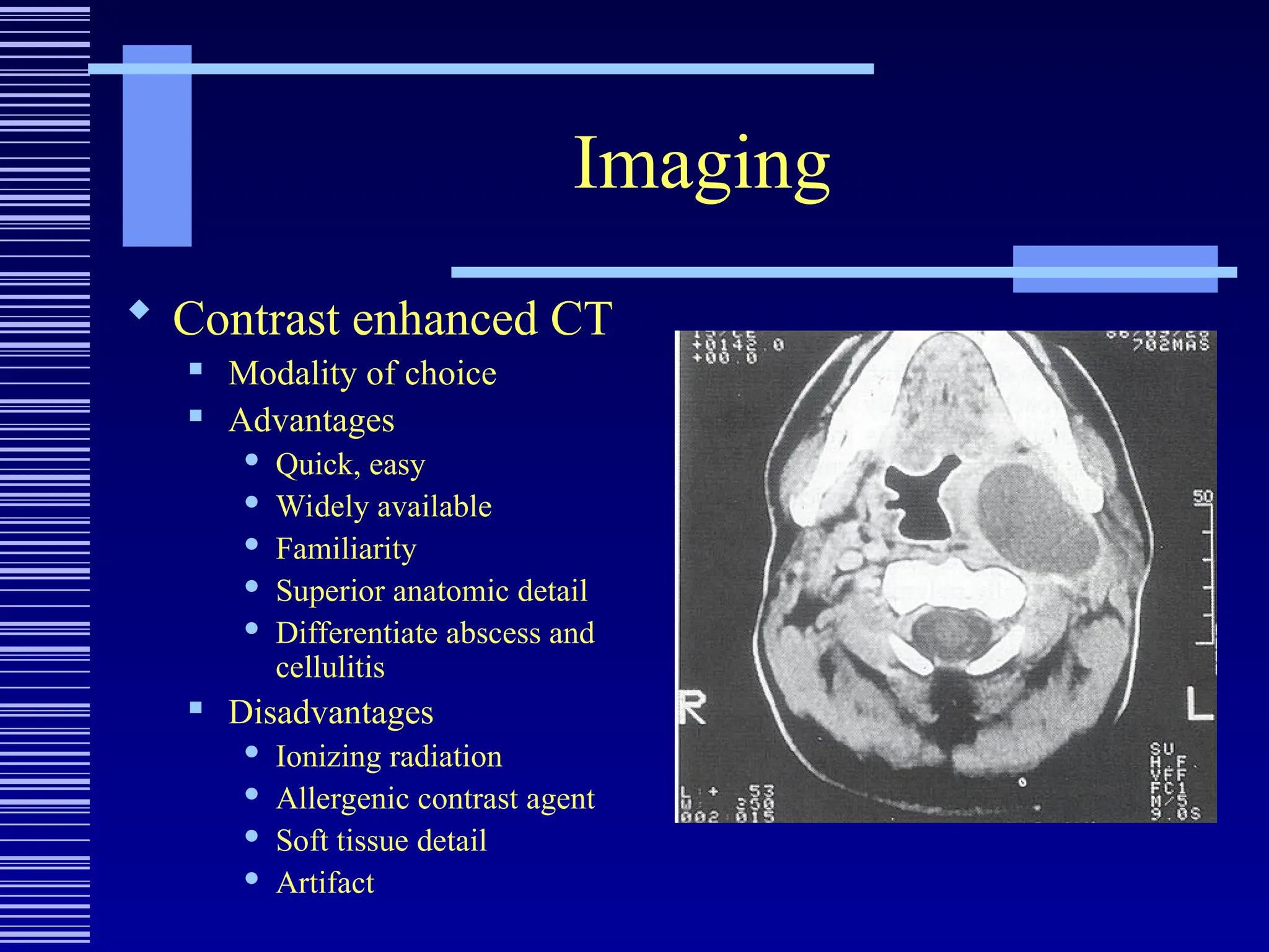 Imaging
 Contrast enhanced CT
 Modality of choice
 Advantages
 Quick, easy
 Widely available
 Familiarity
 Superior anatomic detail
 Differentiate abscess and
cellulitis
 Disadvantages
 Ionizing radiation
 Allergenic contrast agent
 Soft tissue detail
 Artifact
 