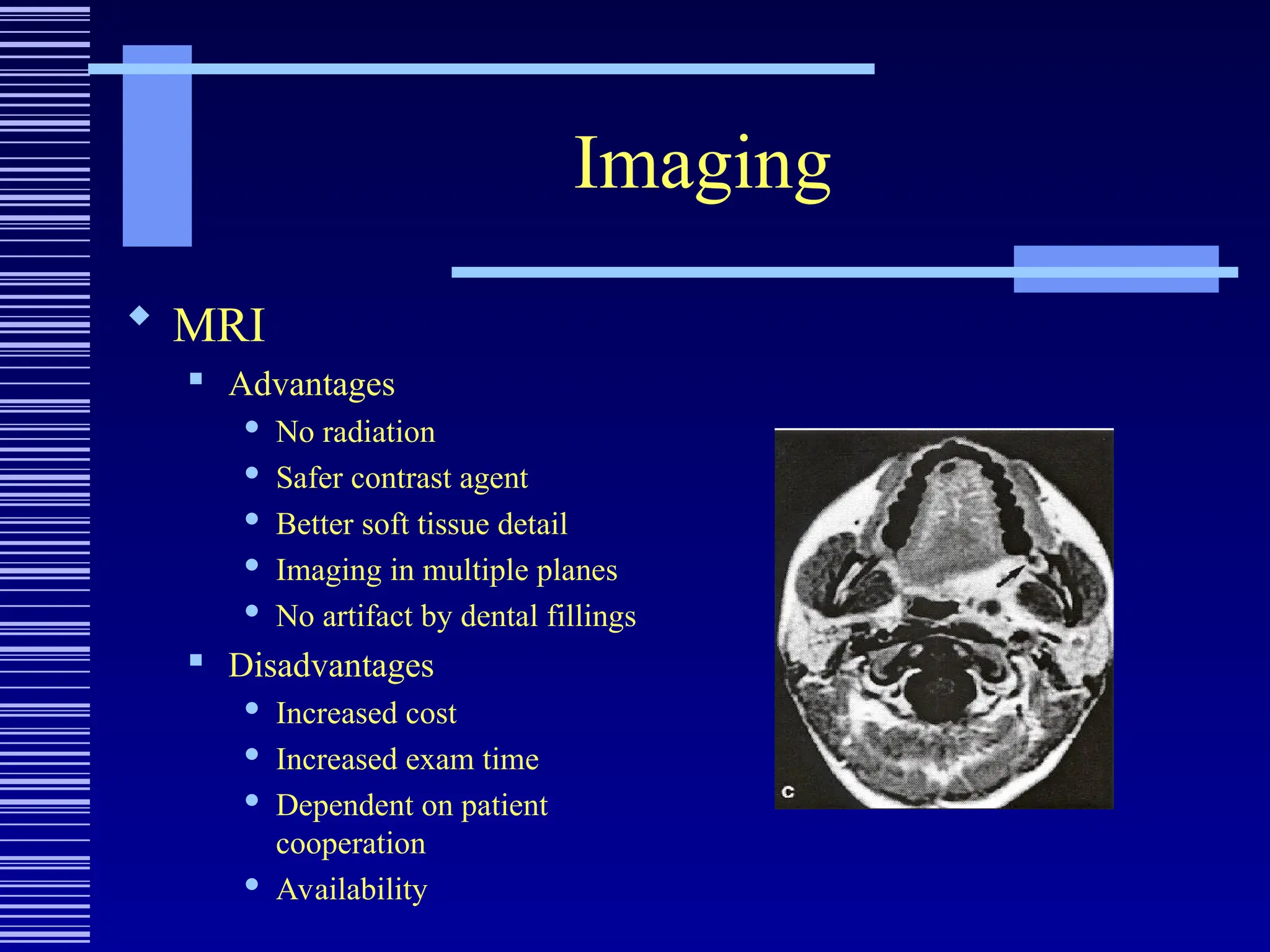 Imaging
 MRI
 Advantages
 No radiation
 Safer contrast agent
 Better soft tissue detail
 Imaging in multiple planes
 No artifact by dental fillings
 Disadvantages
 Increased cost
 Increased exam time
 Dependent on patient
cooperation
 Availability
 
