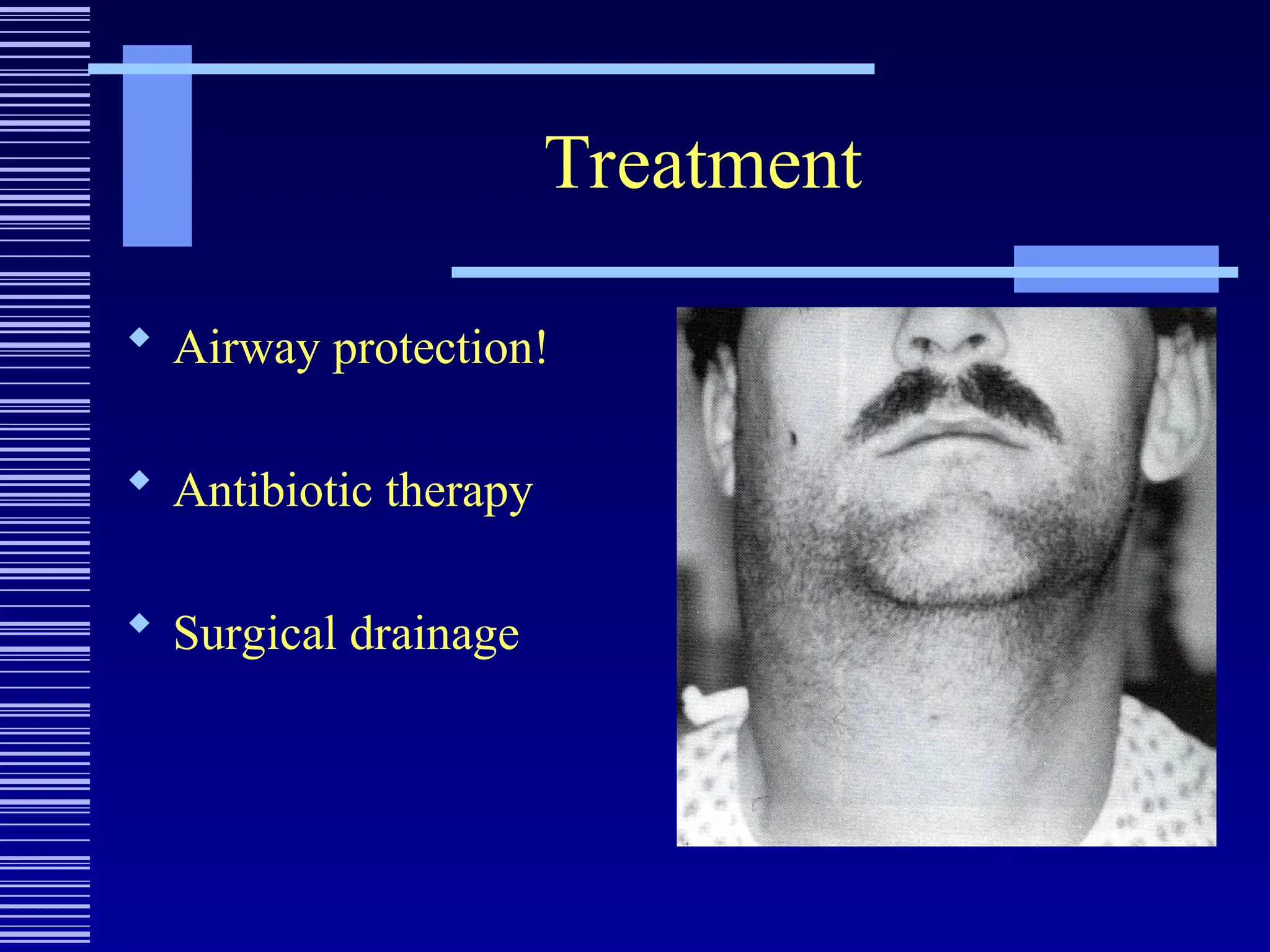 Treatment
 Airway protection!
 Antibiotic therapy
 Surgical drainage
 