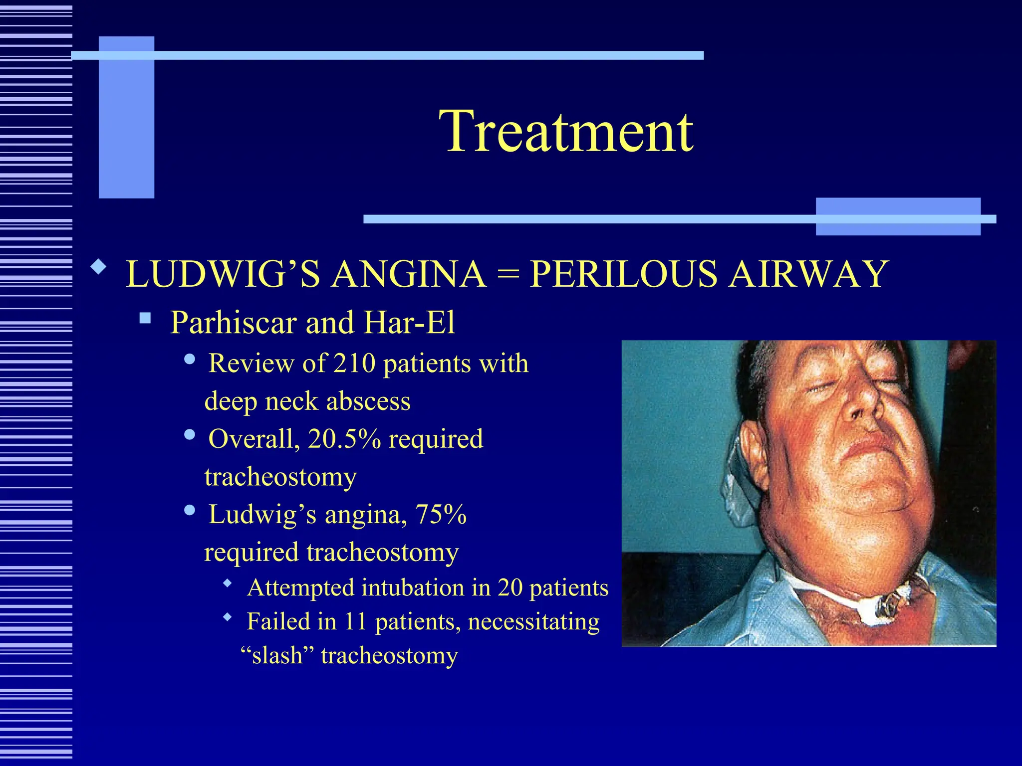 Treatment
 LUDWIG’S ANGINA = PERILOUS AIRWAY
 Parhiscar and Har-El
 Review of 210 patients with
deep neck abscess
 Overall, 20.5% required
tracheostomy
 Ludwig’s angina, 75%
required tracheostomy
 Attempted intubation in 20 patients
 Failed in 11 patients, necessitating
“slash” tracheostomy
 