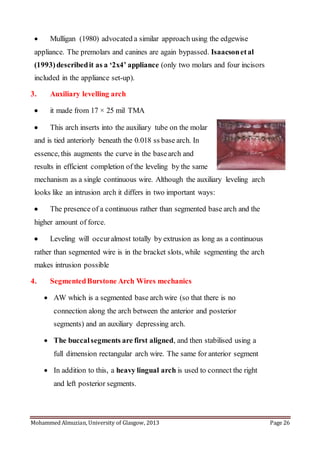 Mohammed Almuzian, University of Glasgow, 2013 Page 26
 Mulligan (1980) advocated a similar approach using the edgewise
appliance. The premolars and canines are again bypassed. Isaacsonetal
(1993)describedit as a ‘2x4’ appliance (only two molars and four incisors
included in the appliance set-up).
3. Auxiliary levelling arch
 it made from 17 × 25 mil TMA
 This arch inserts into the auxiliary tube on the molar
and is tied anteriorly beneath the 0.018 ss base arch. In
essence, this augments the curve in the basearch and
results in efficient completion of the leveling by the same
mechanism as a single continuous wire. Although the auxiliary leveling arch
looks like an intrusion arch it differs in two important ways:
 The presence of a continuous rather than segmented base arch and the
higher amount of force.
 Leveling will occuralmost totally by extrusion as long as a continuous
rather than segmented wire is in the bracket slots, while segmenting the arch
makes intrusion possible
4. SegmentedBurstone Arch Wires mechanics
 AW which is a segmented base arch wire (so that there is no
connection along the arch between the anterior and posterior
segments) and an auxiliary depressing arch.
 The buccalsegments are first aligned, and then stabilised using a
full dimension rectangular arch wire. The same for anterior segment
 In addition to this, a heavy lingual arch is used to connect the right
and left posterior segments.
 