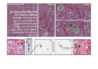 Our Deep Learner Won ICPR
2012 Contest on Mitosis
Detection: First pure Deep
Learner to win a contest on
object detection (in large
images). Very fast MPCNN
scans: Masci, Giusti, Ciresan,
Gambardella, Schmidhuber,
ICIP 2013
 