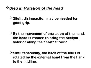 Step II: Rotation of the head
Slight disimpaction may be needed for
good grip.
By the movement of pronation of the hand,
the head is rotated to bring the occiput
anterior along the shortest route.
Simultaneouslty, the back of the fetus is
rotated by the external hand from the flank
to the midline.
 