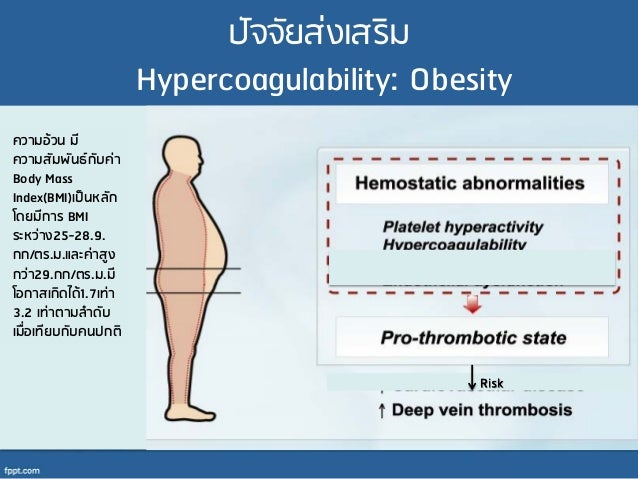 Deep Vein Thrombosis