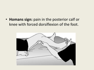 Deep vein thrombosis | PPTX
