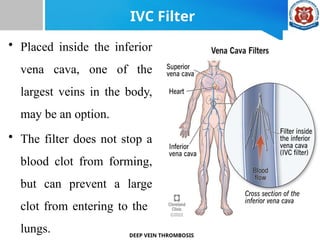 DEEP VEIN THROMBOSIS MEDICAL SURGICAL N. | PPTX