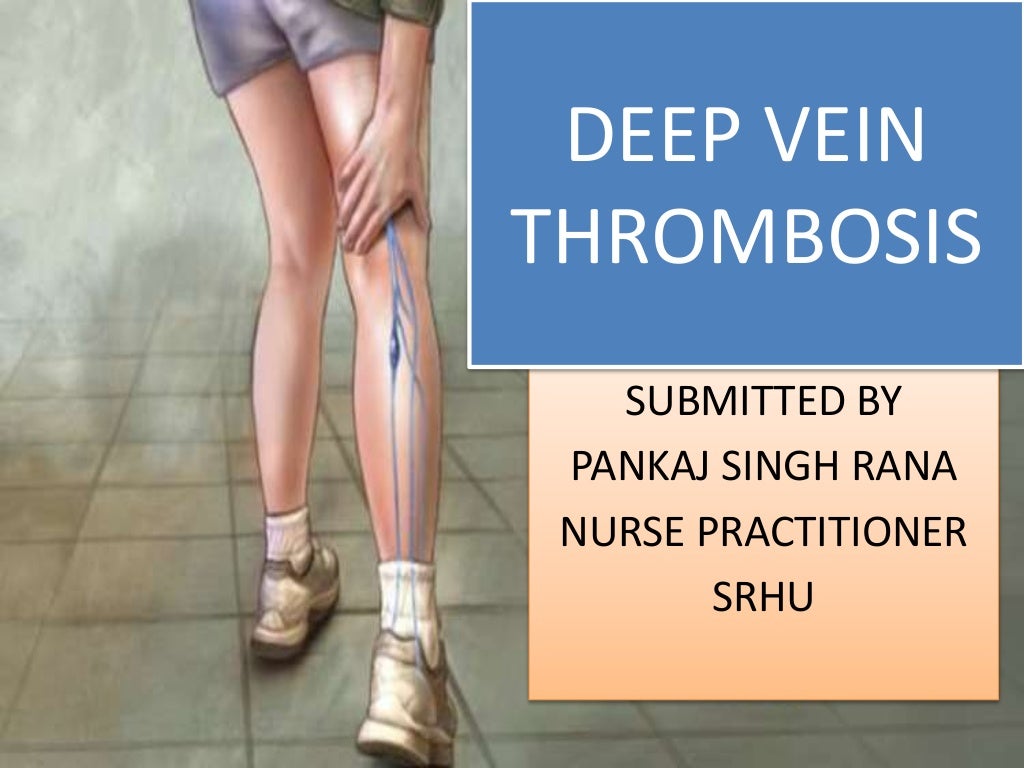 Deep Vein Thrombosis Dvt