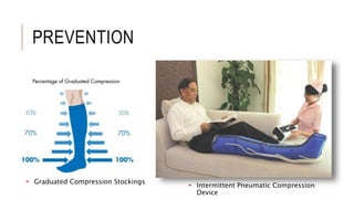 Deep Vein Thrombosis | PPTX