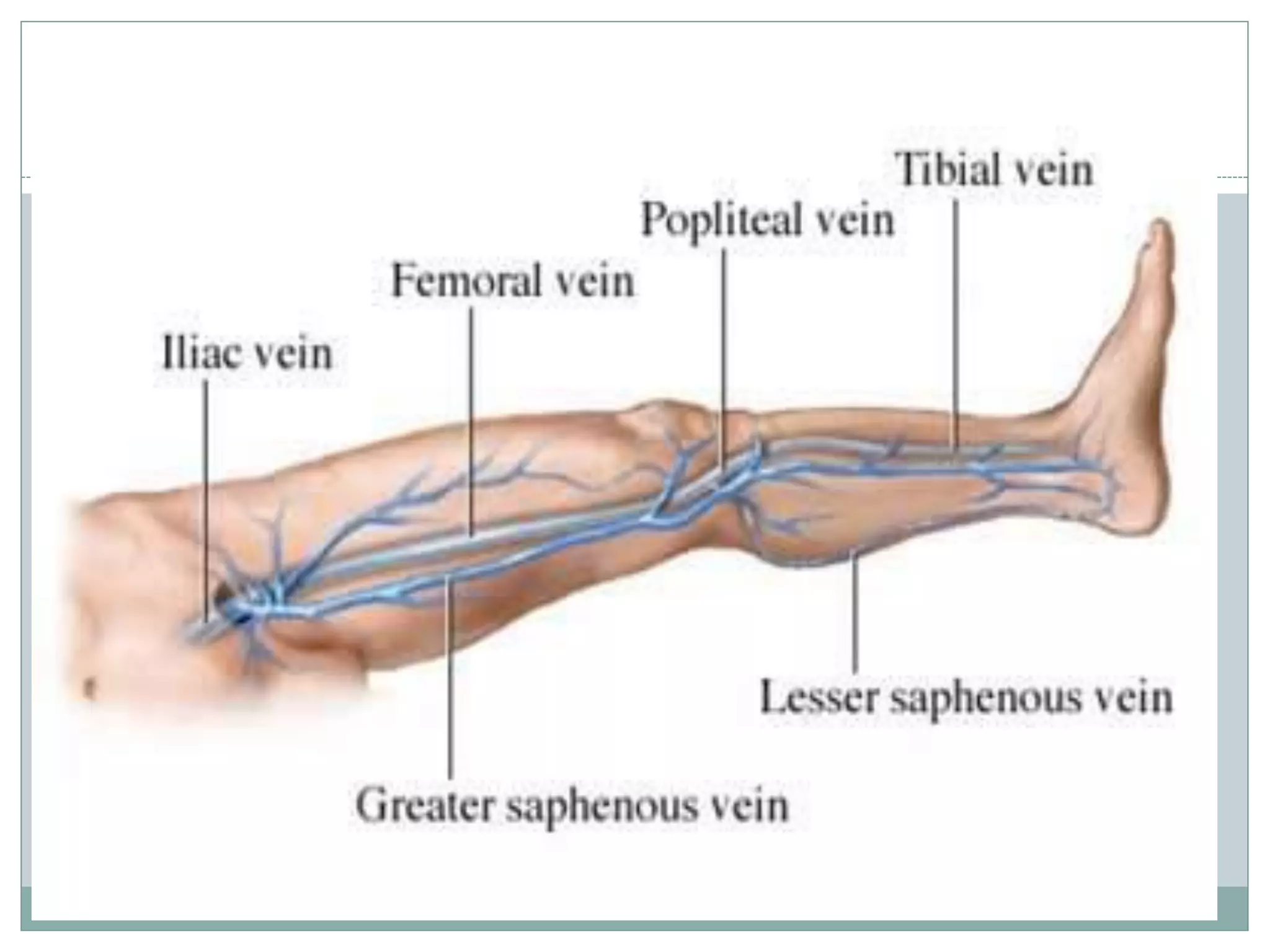 DVT (Deep vein thrombosis) | PDF
