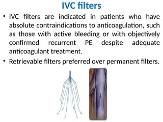 Comprehensive Overview of Deep Vein Thrombosis and Pulmonary Embolism ...