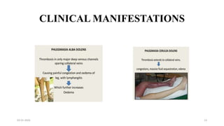 CLINICAL MANIFESTATIONS
03-01-2024 13
 