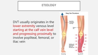 Deep venous thrombosis | PPT
