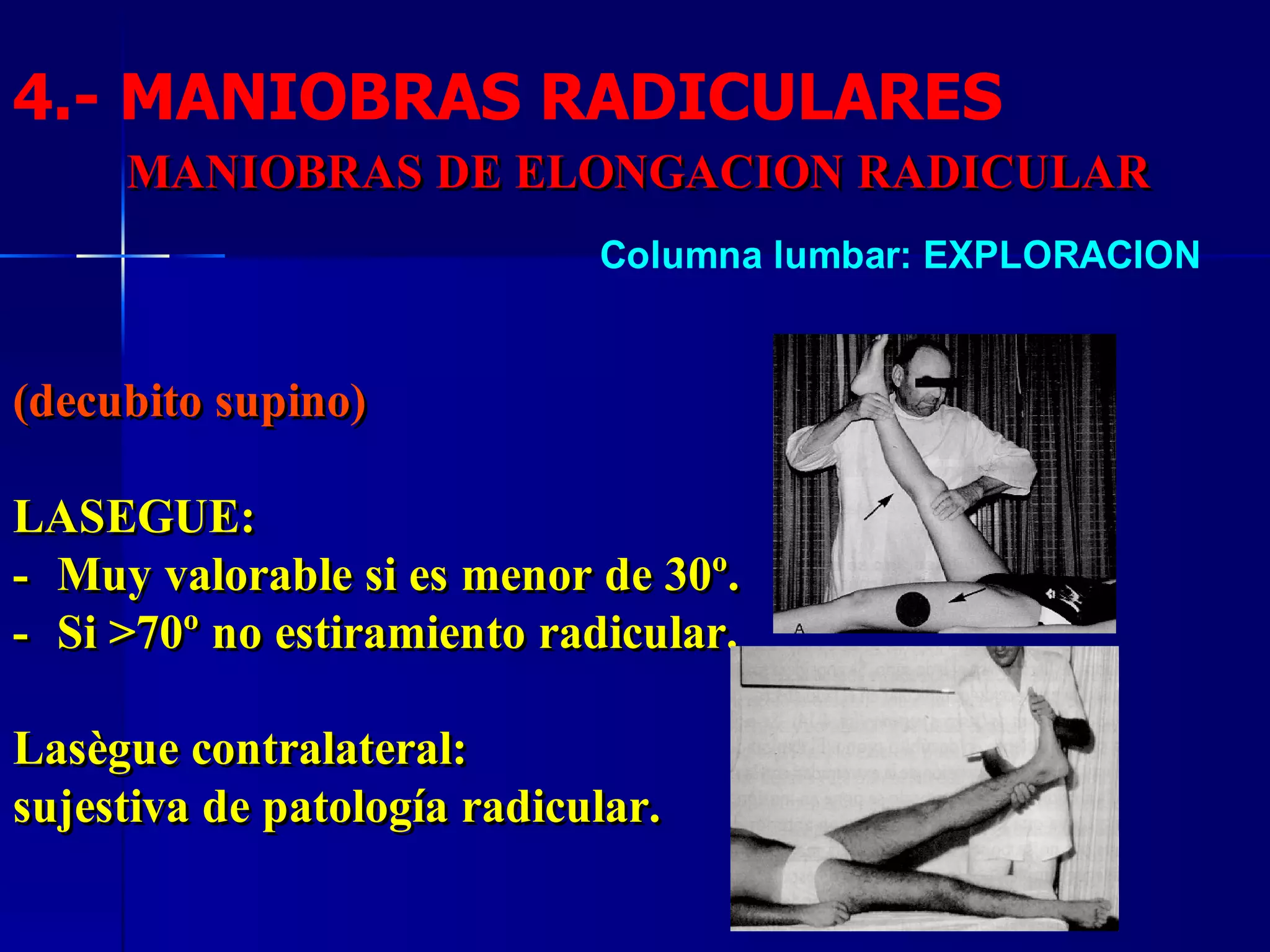 4.- MANIOBRAS RADICULARES 