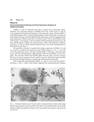 100 Ringel et al.
RESULTS
Immuncytochemical Staining and Flow Cytometric Analysis of
CD44st and CD44v
CD44st, v5, and v6 expression may play a critical role in pancreatic cancer.
Therefore, the expression patterns of CD44st and of the variant exons v5 and v6
were examined by immunocytochemistry in the pancreatic cancer cell lines BxPC-3
(well differentiated), Panc-1 (poorly differentiated), and the SV40 large T transfected
human pancreatic duct cell lines M450 and E4. Both cancer cell lines displayed mod-
erate staining for CD44st (mAb SFF-2), CD44v5 (mAb VFF-8), and CD44v6 (mAb
VFF18) (Fig. 1). In contrast, in the two human SV40 transfected pancreatic duct cell
lines, M540 and E4, CD44st was expressed only weakly until reaching a moderate
level (Fig. 1). The two CD44 variants exhibited only a very weak staining pattern in
M540 and E4 cells (Fig. 1).
We used flow cytometry to quantify the surface expression of CD44st, v5, and
v6 as well as to analyze the expression of the CD44 variants v3, v4, v7, v7/8, and
v10 in the pancreatic cancer cell lines. Besides BxPC-3 and Panc-1, the pancreatic
tumor cell lines PaCa44 (poorly differentiated), SW979, and SW850 were investi-
gated. The cell lines SW979 and SW850 differ from the other cell lines, because
they have no known mutations in p53 and Ki-ras genes, which have been described
as occurring with high frequency in pancreatic adenocarcinoma cells [28].
Flow Cytomentry demonstrated CD44st, v5, and v6 in the cell lines BxPC-1
and Panc-1, (Fig. 2, Table 1) that further supported the immunochemical findings.
Fig. 1. Immunocytochemistry for CD 44 and variants. Immunocytochemical staining of the human
pancreatic carcinoma cell line BxPC-3 (A,B) and the human SV40 immortalized duct cells E4 (C,D)
using the antibodies SFF-2 against CD44st (A,C) and VFF-18 against CD44v6 (B,D). Note the intense
staining of CD44st and CD44v6 in the BxPC-3 cells (A,B) and the weak expression in the ductal cell
line E4 (C,D).
 