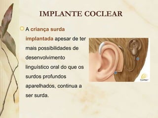 IMPLANTE COCLEAR
A criança surda
implantada apesar de ter
mais possibilidades de
desenvolvimento
linguístico oral do que os
surdos profundos
aparelhados, continua a
ser surda.
 