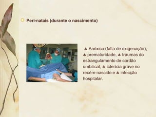 Peri-natais (durante o nascimento)




                             Anóxica (falta de oxigenação),
                            prematuridade, traumas do
parto,                    estrangulamento de cordão
                          umbilical, icterícia grave no
                          recém-nascido e infecção
                          hospitalar.
 