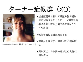 `ʩ`֢ȺXO
? żӤˤƜpѤǽM
椨ʤäȡXz
Θ쮐?ѤǤΥ⥶
ʤɤԭ
? 98%̥Ȼb
? òŮԤюzʤ

? 礬״Ǥؤηڤפ
gڤ
Johannes NielsenӰCC-BY-2.0
 