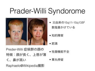 Prader-Willi Syndorome
? 15q11-15q13
cƤ
? ֪Ϻ
? ʜ
? ٙCܲȫ
? غͣ
Preder-Willi ֢Ⱥ
؏գLϴ
Ǥߤ
Raphaelo@WikipediaӰ
 