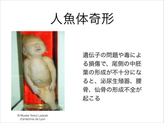 ~
zӤΆ}䶾ˤ
pǡβȤ
~γɤʮ֤ˤ
ȡֳ
ǡɹǤγɲȫ
𤳤
? Muse Testut Latarjet
d'anatomie de Lyon
 
