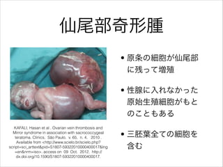 β[
? ԭμβ
˲ФäƉֳ
? ٤ʤä
ԭʼֳ
ΤȤ⤢
? ~ȫƤμ

KAFALI, Hasan et al . Ovarian vein thrombosis and
Mirror syndrome in association with sacrococcygeal
teratoma. Clinics, S?o Paulo, v. 65, n. 4, 2010 .
Available from <http://www.scielo.br/scielo.php?
script=sci_arttext&pid=S1807-59322010000400017&lng
=en&nrm=iso>. access on 09 Oct. 2012. http://
dx.doi.org/10.1590/S1807-59322010000400017.
 
