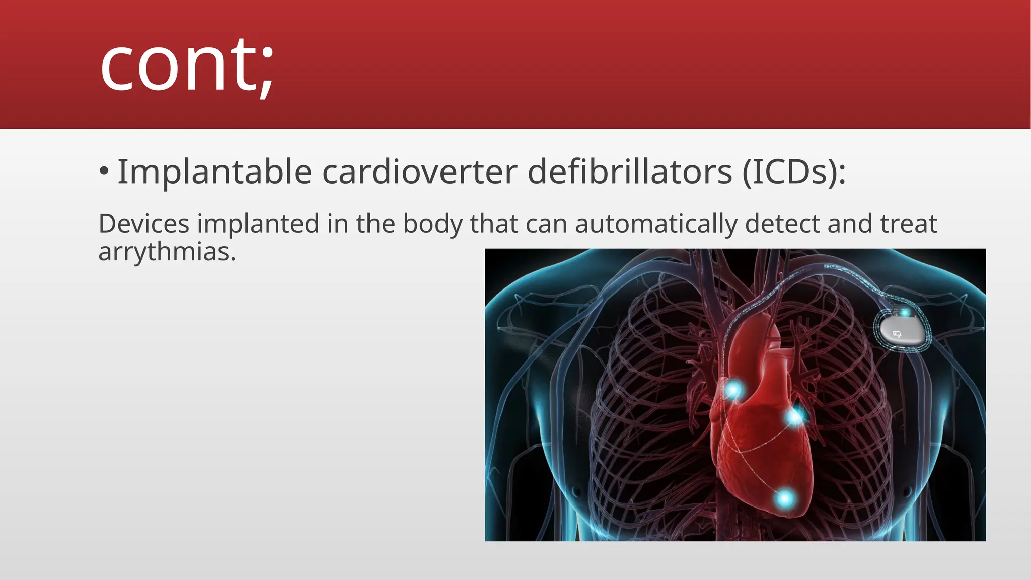 cont;
• Implantable cardioverter defibrillators (ICDs):
Devices implanted in the body that can automatically detect and treat
arrythmias.
 